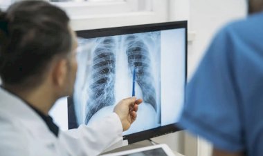 Secretaria de Saúde de Viçosa anuncia mudanças na marcação de exames de Raio-X